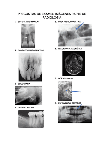 PREGUNTAS-DE-EXAMEN-IMAGENES-PARTE-DE-RADIOLOGIA.pdf
