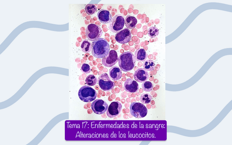 Tema-17-Enfermedades-de-la-sangre-Alteraciones-de-los-leucocitos..pdf
