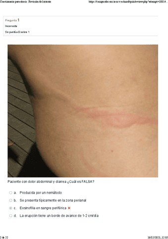 C7.-Respuestas-Parasitosis.pdf