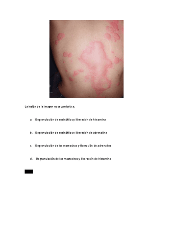 C14y26.-Uticaria-y-Toxicodermia.pdf