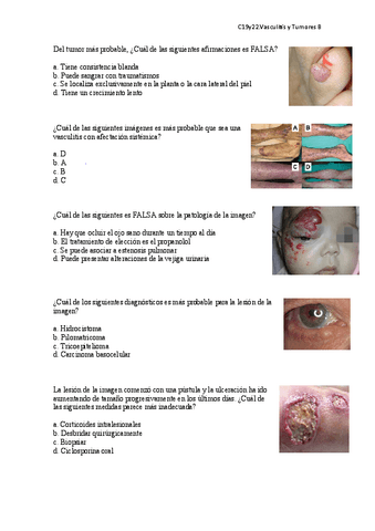 C19y22.-Vasculitis-y-tumores-benignos.pdf