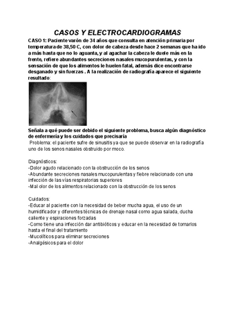 CASOS-Y-ELECTROCARDIOGRAMAS.pdf