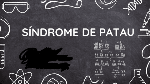 Sindrome-de-Patau.pdf