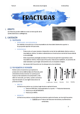 Tema-5-Fracturas.pdf