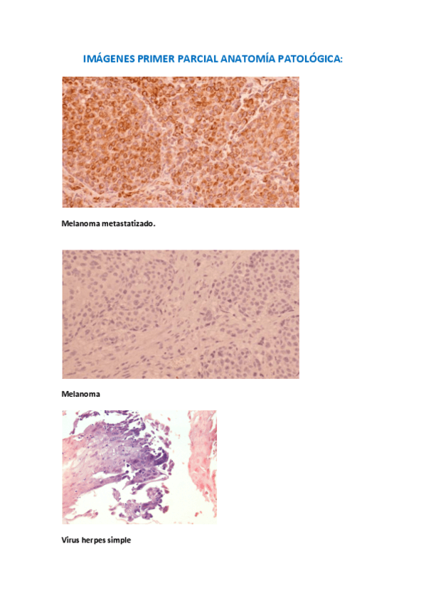 Miniatura del documento IMAGENES-PRIMER-PARCIAL-ANATOMIA-PATOLOGICA.pdf