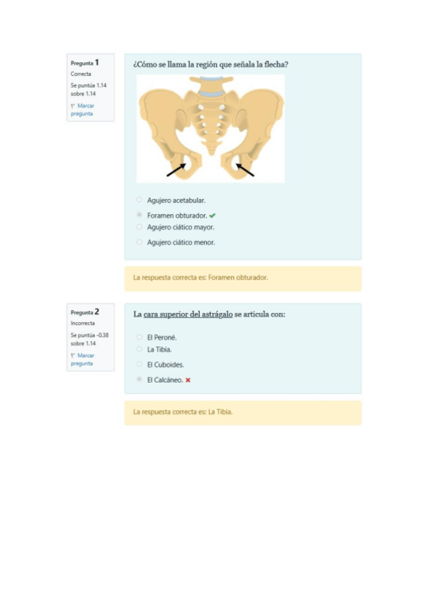 Miniatura del documento Solucion-Minitest-Osteo-Artrologia-del-miembro-inferior.pdf