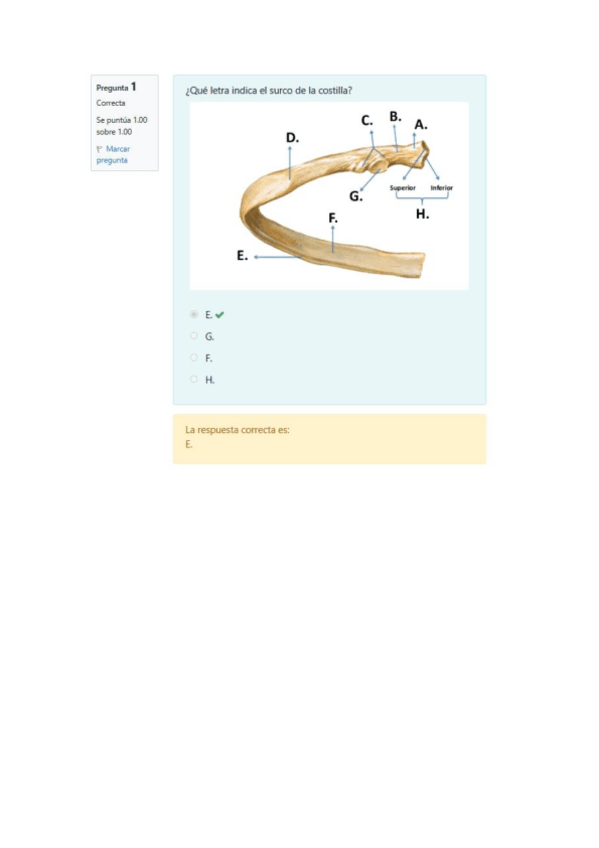 Miniatura del documento Solucion-Minitest-Osteo-Artrologia-del-tronco.pdf