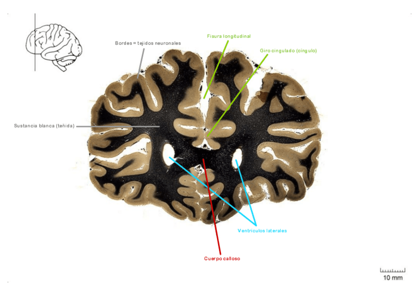 Miniatura del documento Practica-de-Neuroanatomia.pdf