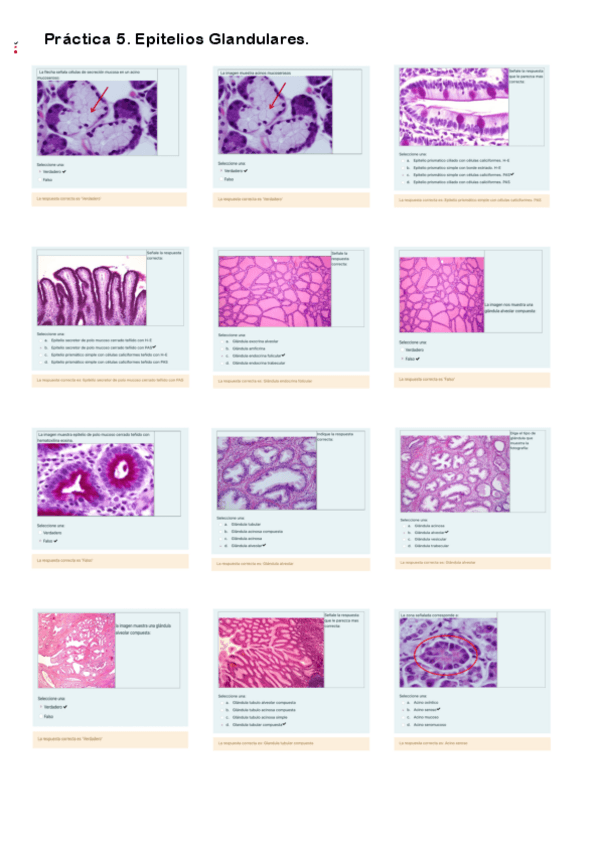 Miniatura del documento Cuestionario Práctica 5. Epitelios Glandulares.pdf
