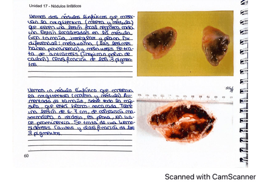 Miniatura del documento PRACTICA-17-NODULOS-LINFATICOS.pdf