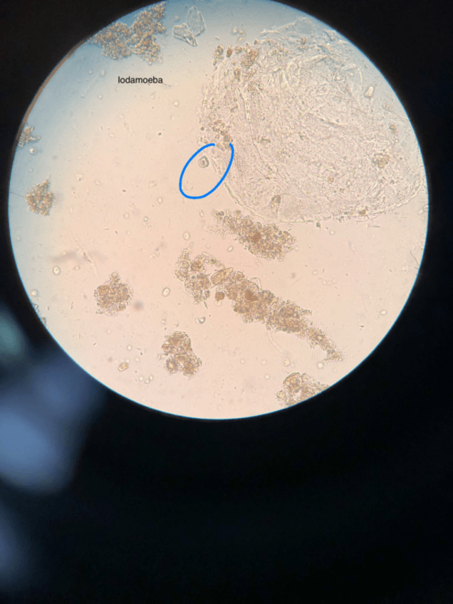 Miniatura del documento practicas-dia-1-parasitologia.pdf