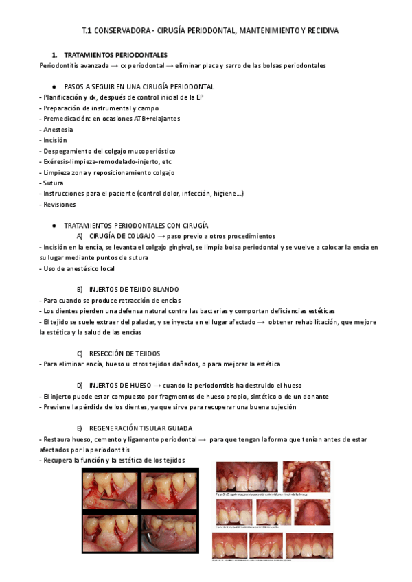 Miniatura del documento T.1-CIRUGIA-PERIODONTAL.pdf