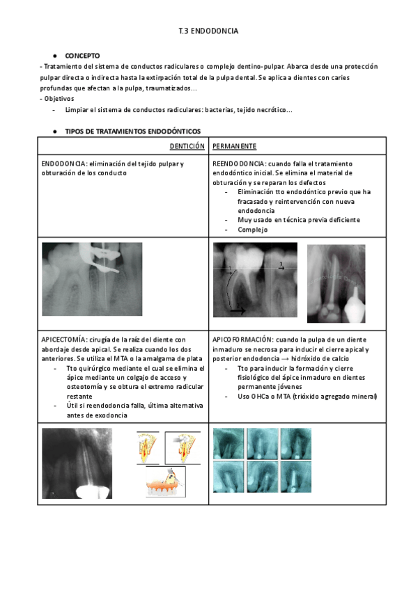 Miniatura del documento T.3-ENDODONCIA.pdf