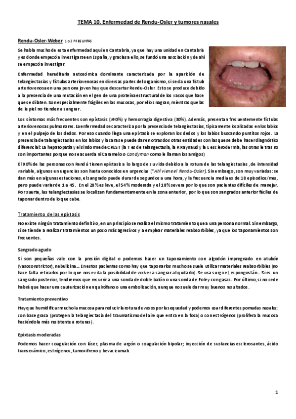 Miniatura del documento Tema 17. Rendu-Osler y tumores nasales.pdf