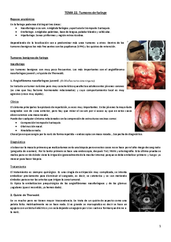 Miniatura del documento Tema 22. Tumores de faringe.pdf