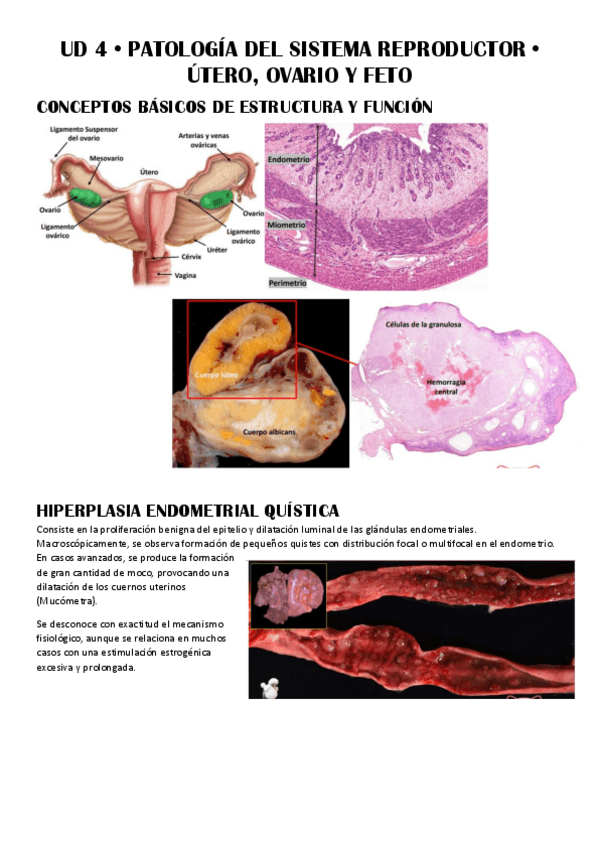 Miniatura del documento UD-4--Patologia-del-Sistema-Reproductor.pdf