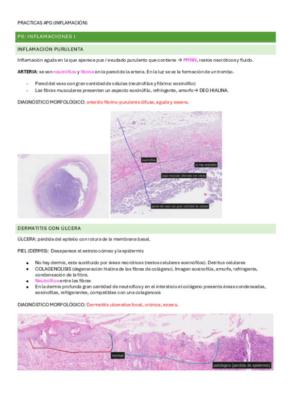 Miniatura del documento PRACTICAS-APG-inflamacion-9-10-11.pdf
