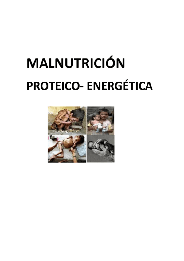 Miniatura del documento MALNUTRICIÓN.pdf