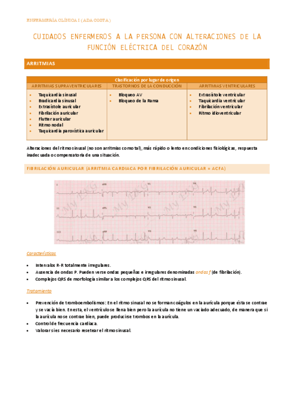 Miniatura del documento Cuidados-enfermeros-a-la-persona-con-alteraciones-de-la-funcion-electrica-del-corazon.pdf