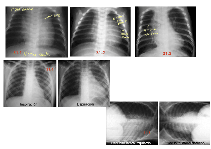 Miniatura del documento ANEXO-T31.pdf