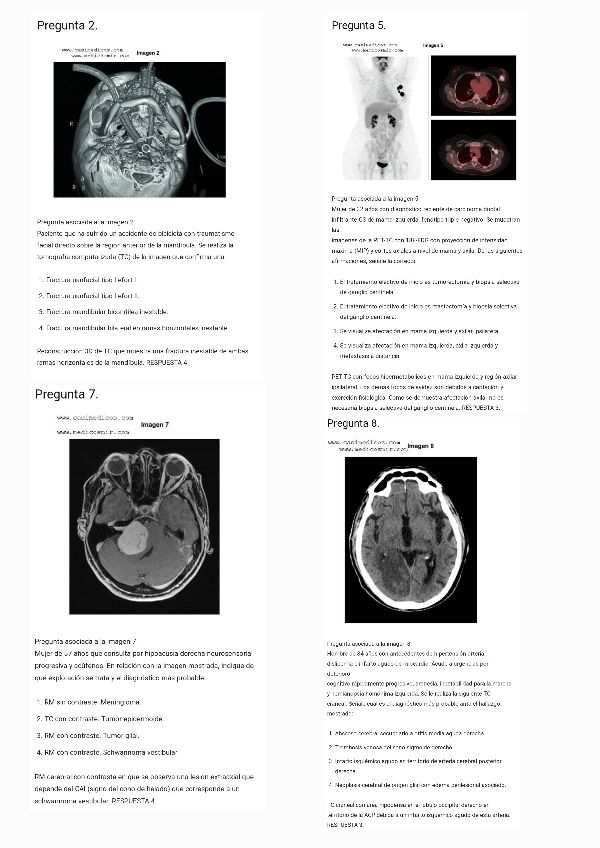 Miniatura del documento Preguntas-MIR-2024-Radiologia240614183826.pdf