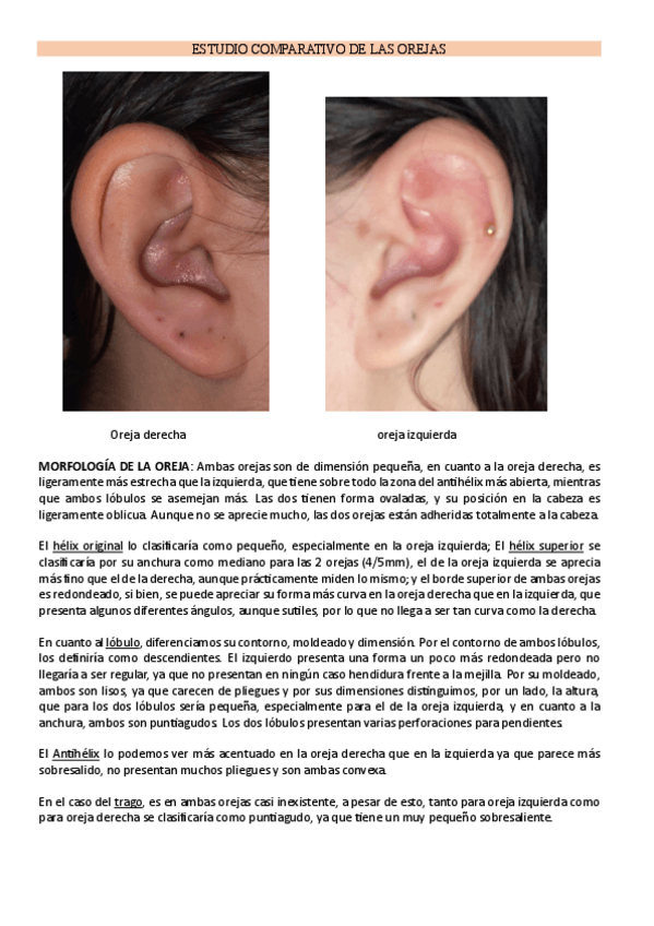 Miniatura del documento ESTUDIO-COMPARATIVO-DE-LAS-OREJAS.pdf