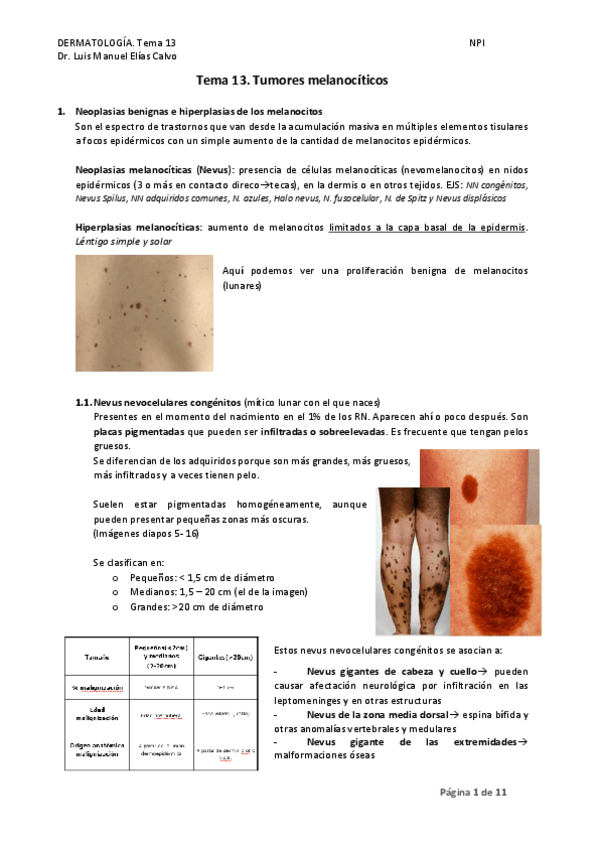 Miniatura del documento TEMA-13.-TUMORES-MELANOCITICOS.pdf