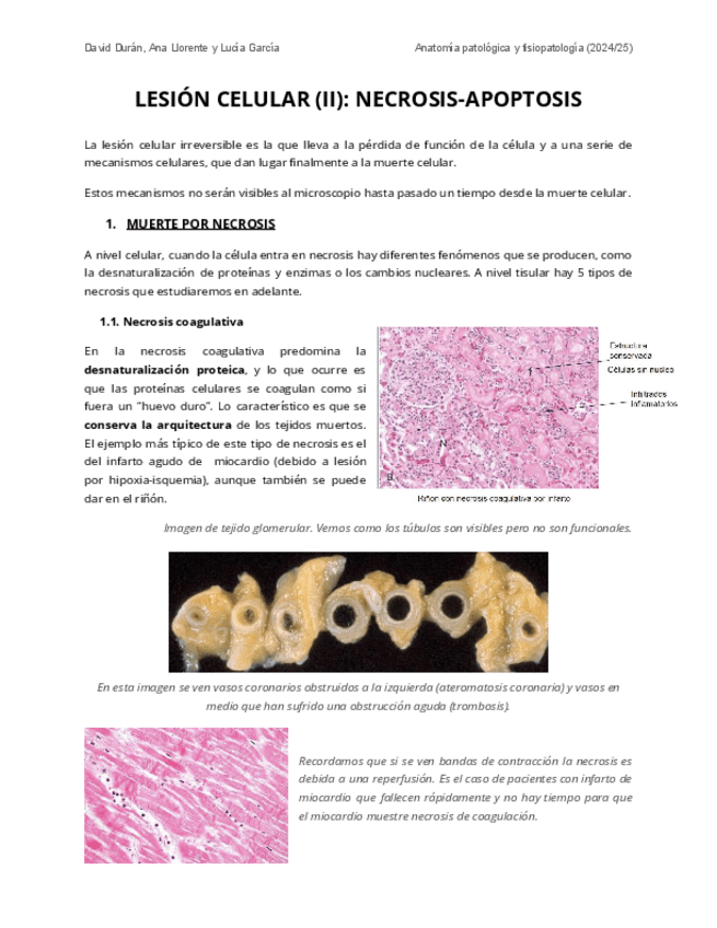 Miniatura del documento Tema 3: Necrosis-Apoptosis. Matias Guiu.pdf