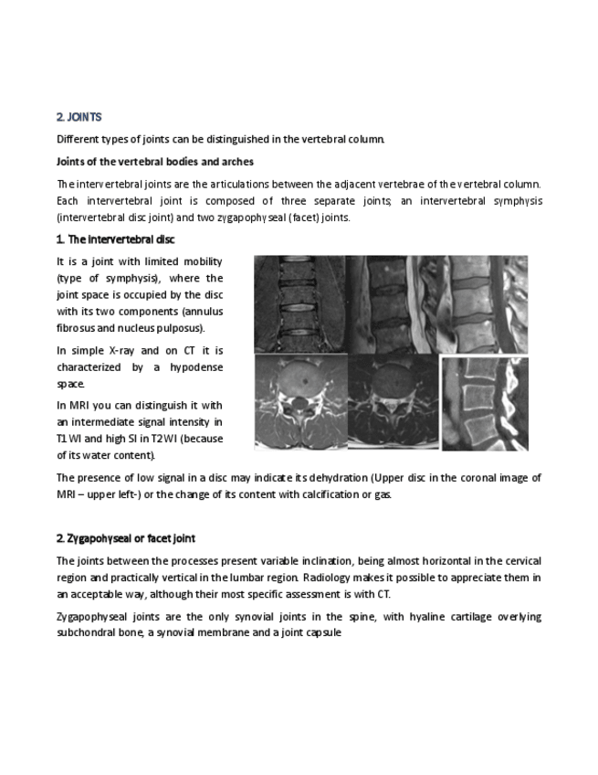 Miniatura del documento Spine-part-II.pdf