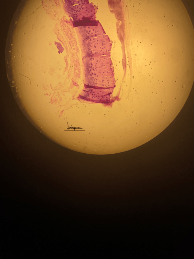 Miniatura del documento 3.1-esta-partit-en-3-perque-era-molt-gran.pdf