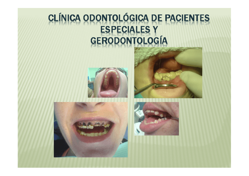 Miniatura del documento 1-Introduccion-y-generalidades-del-Paciente-Especial.pdf