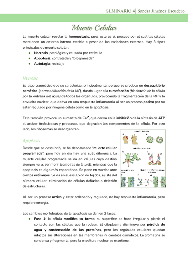 Miniatura del documento Seminario-4-Muerte-Celular.pdf