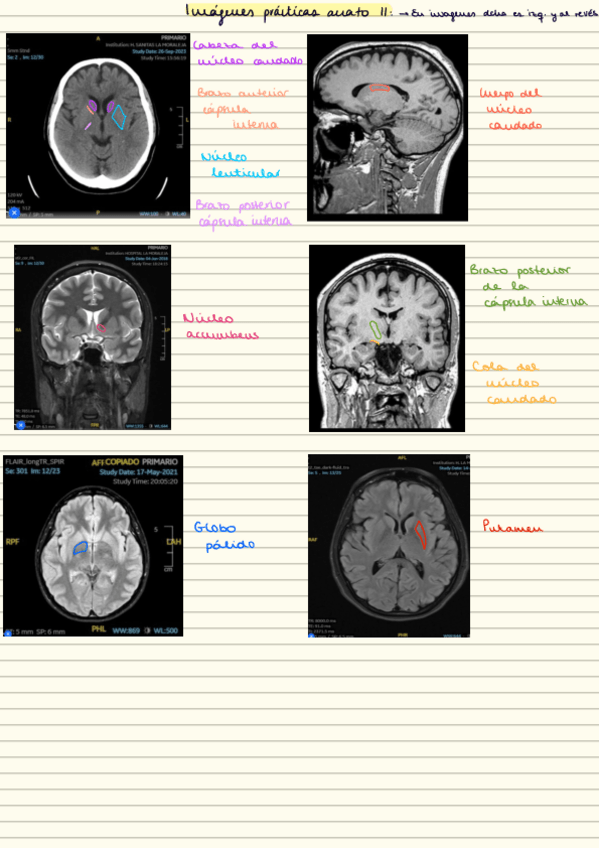 Miniatura del documento practicas-imagenes-resonancias.pdf