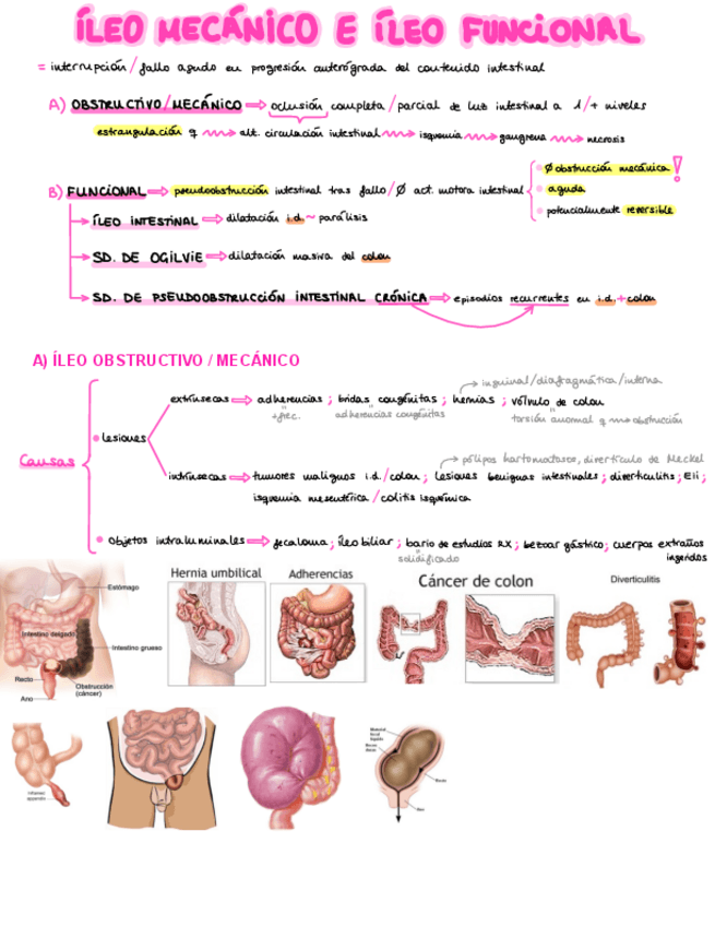 Miniatura del documento 13.-Ileo-mecanico-e-ileo-funcional-Ana.pdf