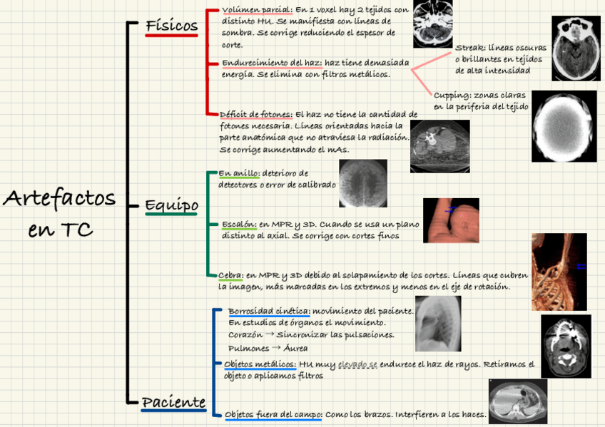 Miniatura del documento ESQUEMA-ARTEFACTOS-TOMOGRAFIA-COMPUTARIZADA-TC.pdf