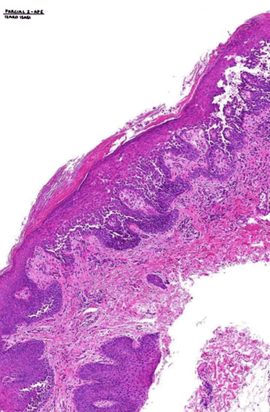 Miniatura del documento parcial-2-APE.pdf
