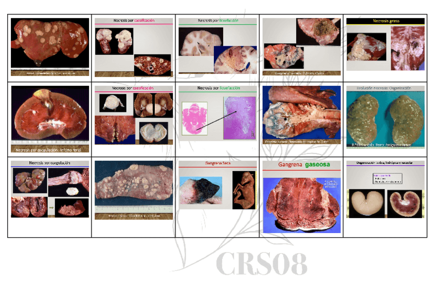 Miniatura del documento REUMEN-IMAGENES-1o-CUATRI.pdf