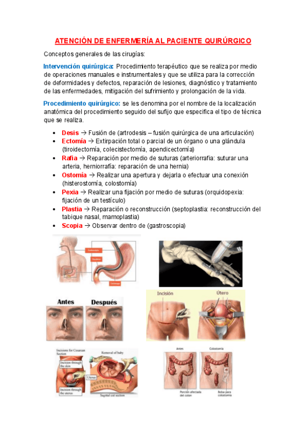 Miniatura del documento ATENCION-DE-ENFERMERIA-AL-PACIENTE-QUIRURGICO.pdf