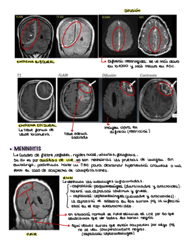 Miniatura del documento Resumen-Neuro-Rx-parte-2.pdf
