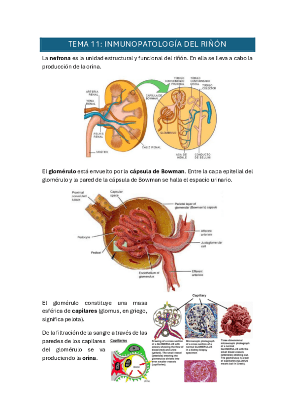 Miniatura del documento Tema-11-y-13.pdf
