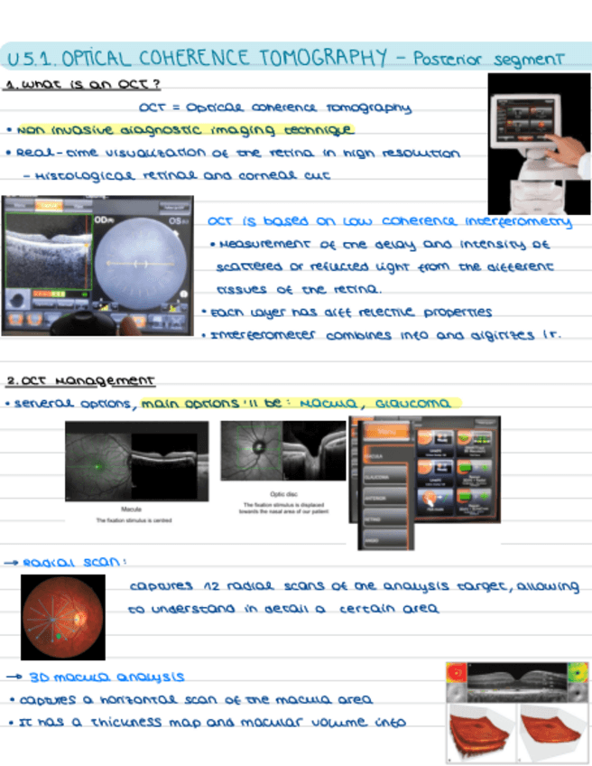 Miniatura del documento U5.1.OCT-PosteriorSegment.pdf