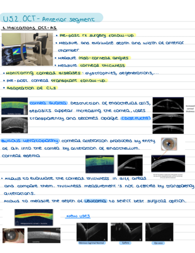 Miniatura del documento U5.2.OCT-AnteriorSegment.pdf