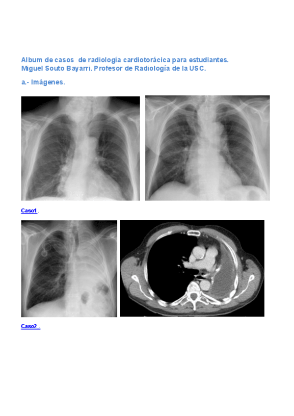 Miniatura del documento Casos-clinicos-Souto.pdf