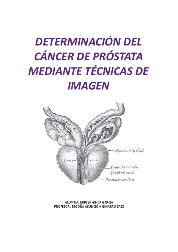 Miniatura del documento Proyecto-Cancer-prostata.pdf