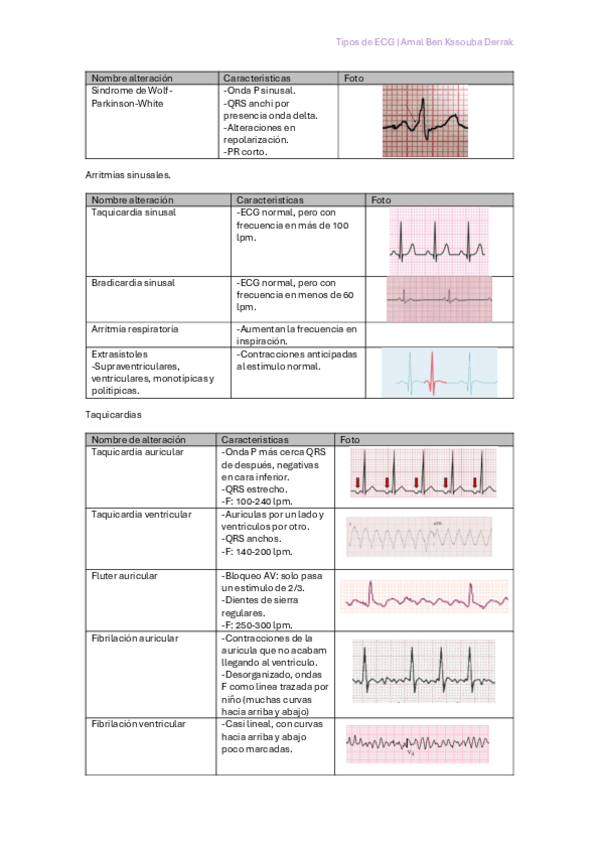 Miniatura del documento Tipos-de-ECG-tablas-e-imagenes.pdf