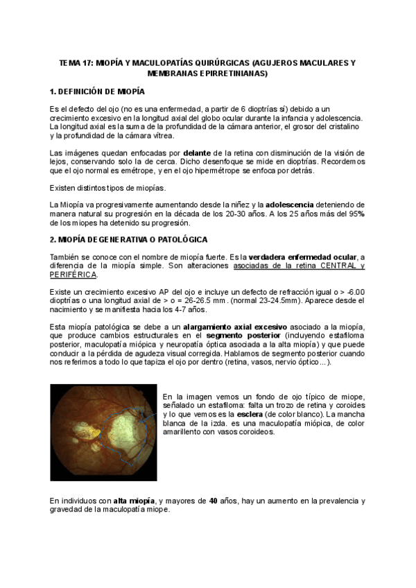 Miniatura del documento TEMA-17-MIOPIA-Y-MACULOPATIAS.pdf