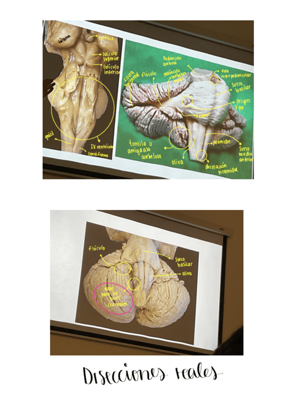 Miniatura del documento Practico-neuroanatomia.pdf