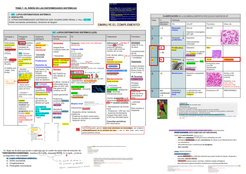 Miniatura del documento 7.-El-Rinon-En-Enfermedades-Sistemicas.pdf
