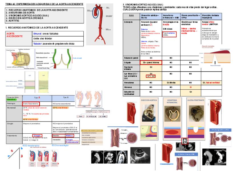 Miniatura del documento 45.-Enfermedades-Adquiridas-De-La-Aorta-Ascendente.pdf