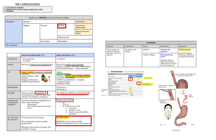 Miniatura del documento 7.-Tumores-De-Esofago.pdf